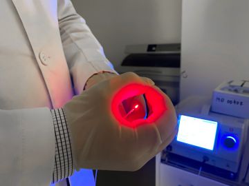 Хирургическое лечение свищей прямой кишки с использованием лазера